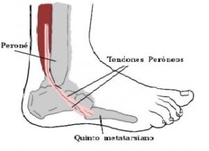 tendon peroneo