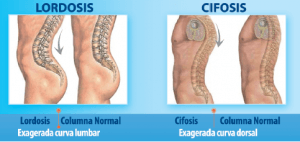 Curvaturas anatómicas